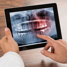 Digital X-ray