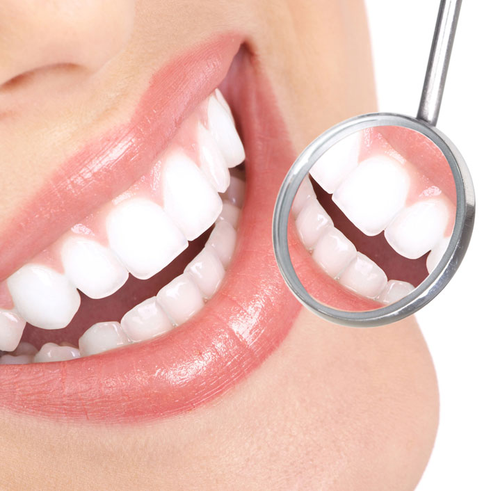 In-Office Whitening